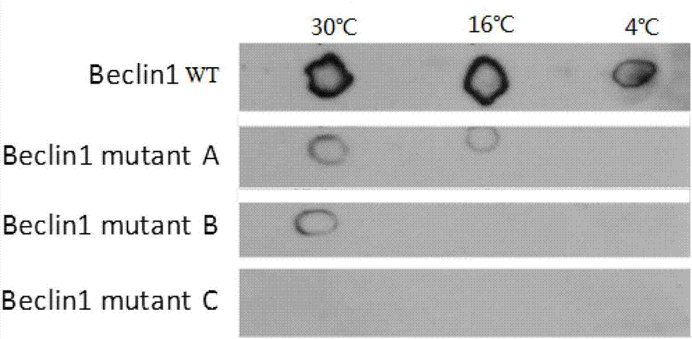 Rectal tumor marker and application thereof and kit