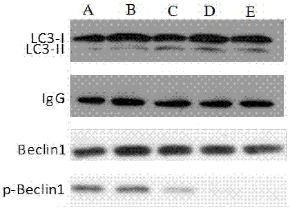 Rectal tumor marker and application thereof and kit