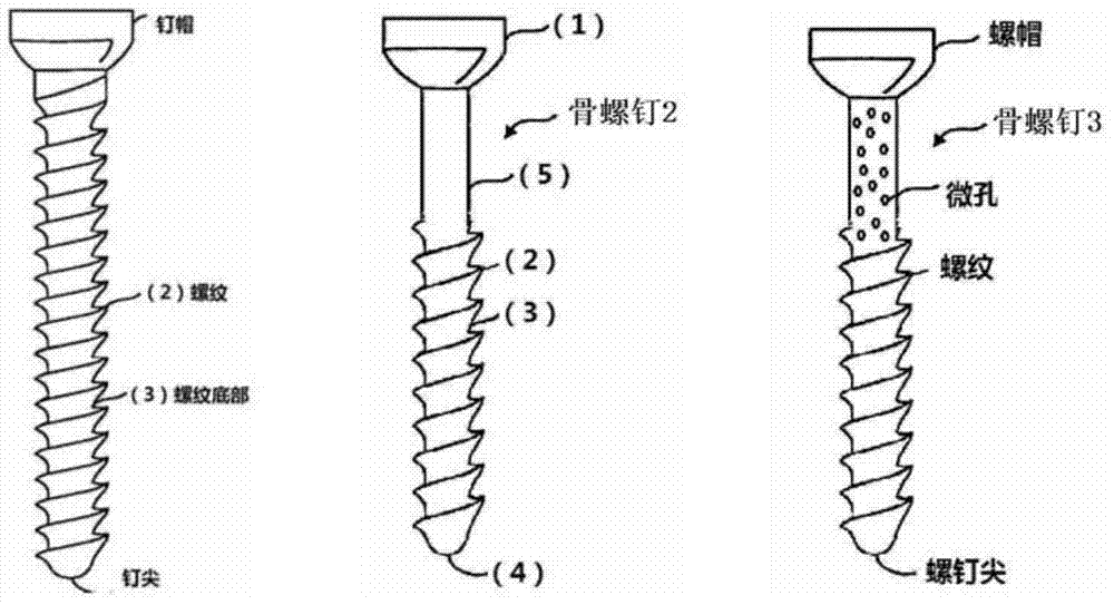 Bone injury repairing and fixing apparatus and preparation method thereof