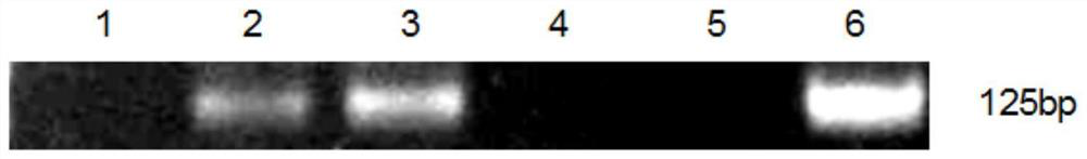 A method for constructing recombinant adenovirus using anp or iganp gene, recombinant adenovirus and application