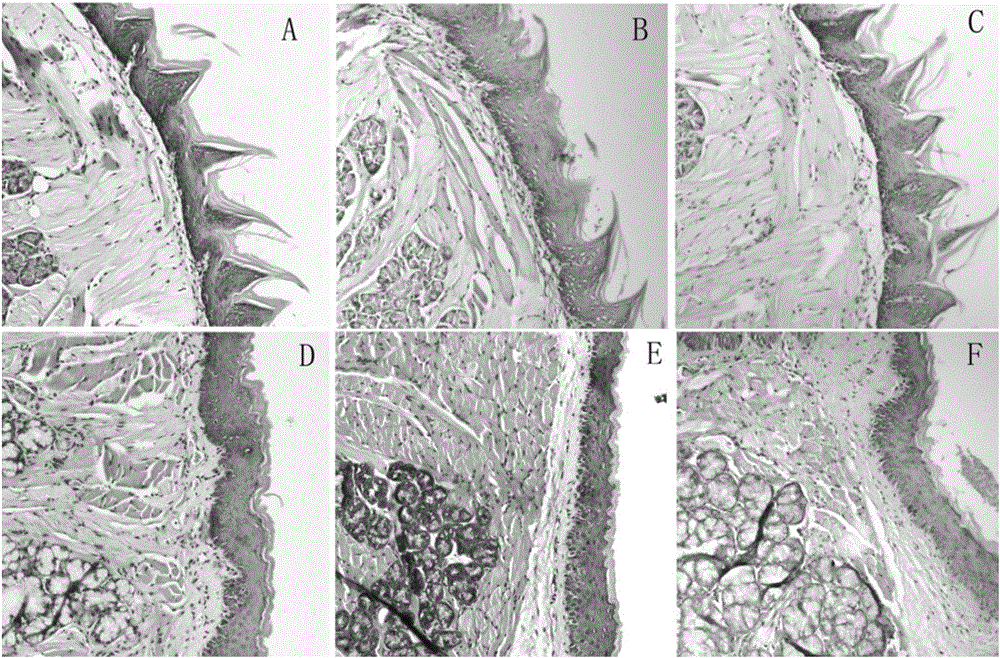 Construction method of oral submucous fibrosis mouse model