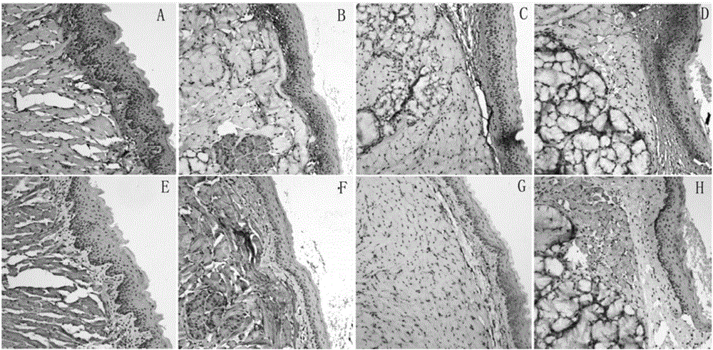 Construction method of oral submucous fibrosis mouse model