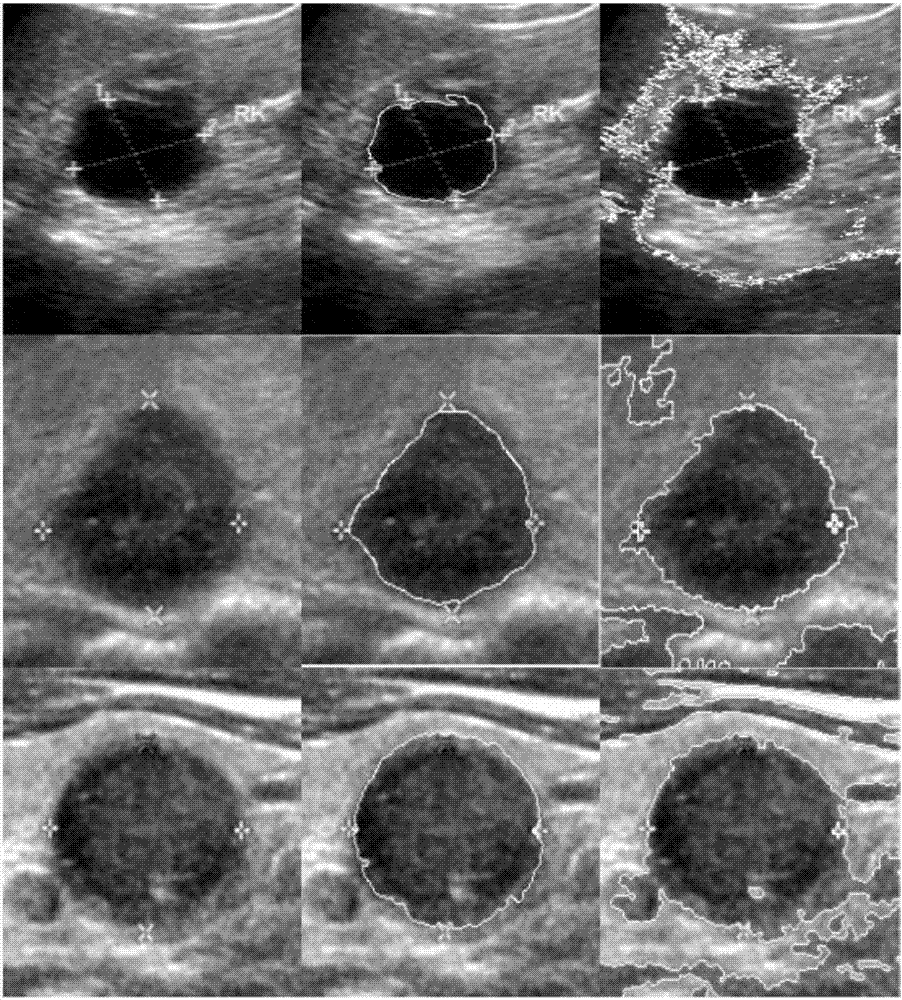 Semi-automatic medical image segmentation method based on shape constraint of point distance function