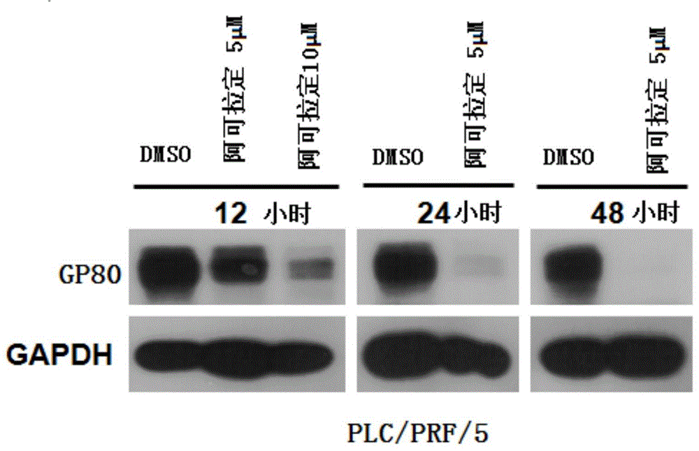 Use of icaritin in preparation of drugs for treating GP80 related diseases