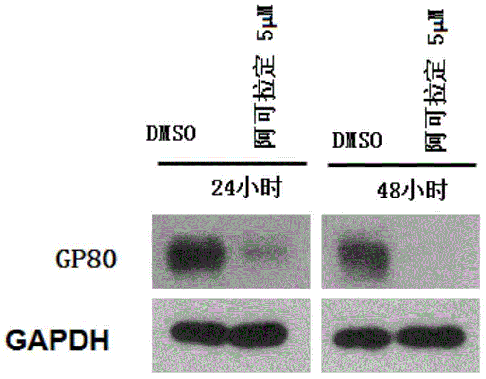 Use of icaritin in preparation of drugs for treating GP80 related diseases