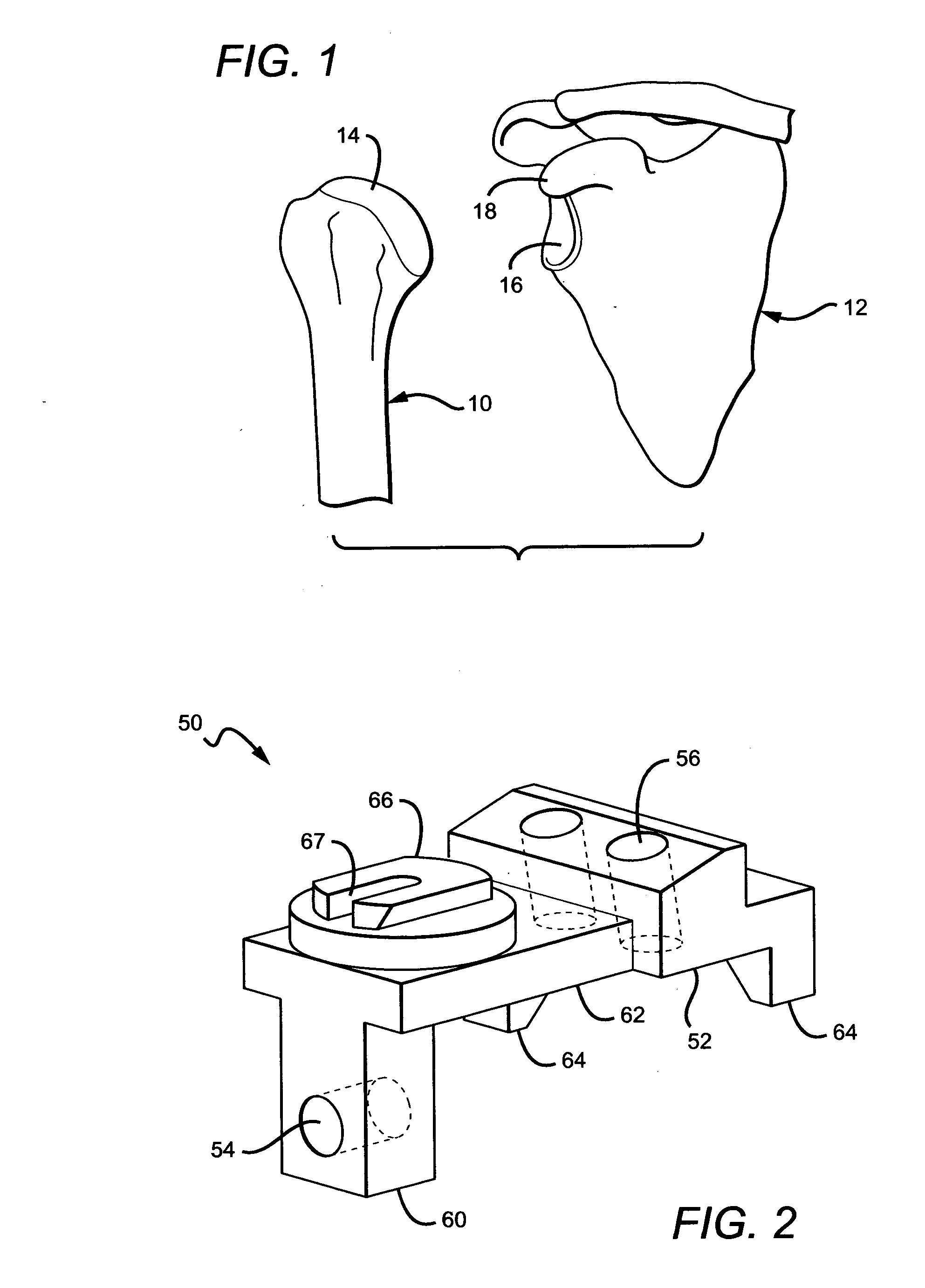 Tracking tools and method for computer-assisted shoulder replacement surgery