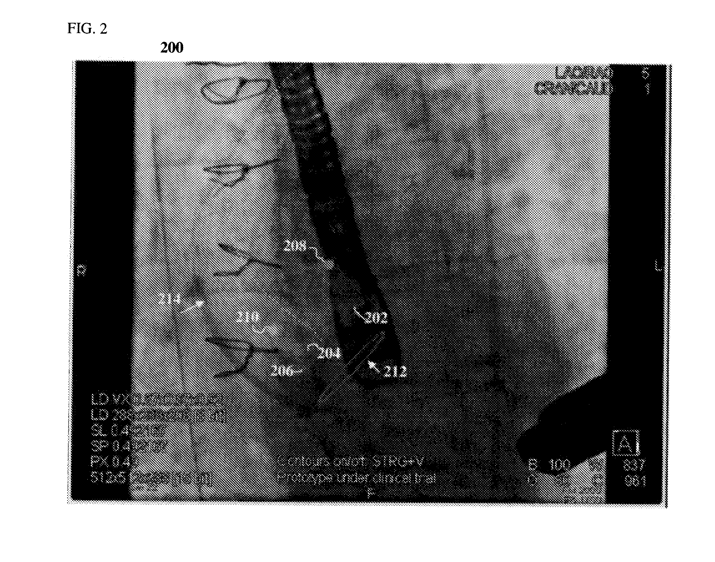 Method and Apparatus for Determining Angulation of C-Arm Image Acquisition System for Aortic Valve Implantation