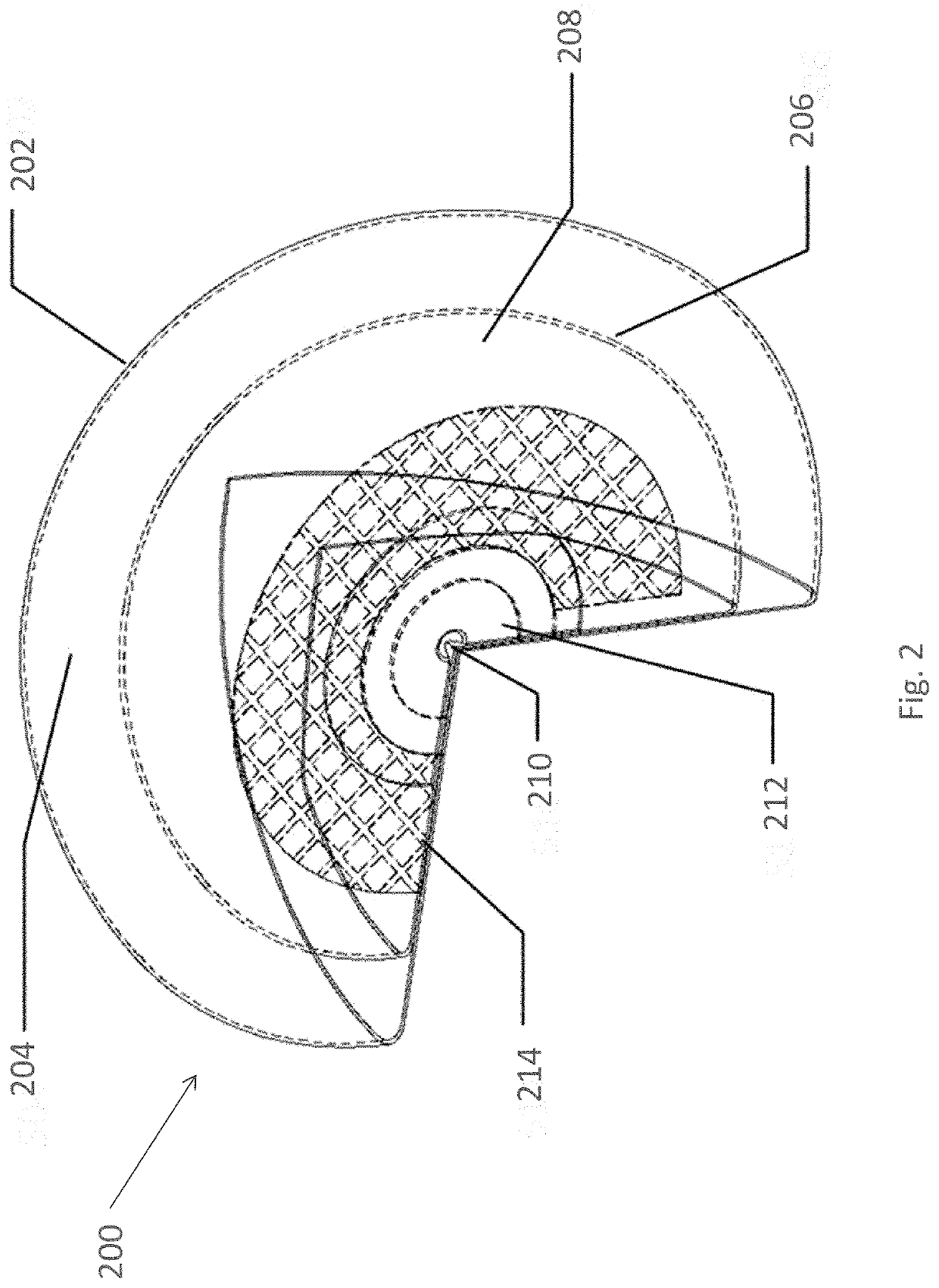 Composite implant material