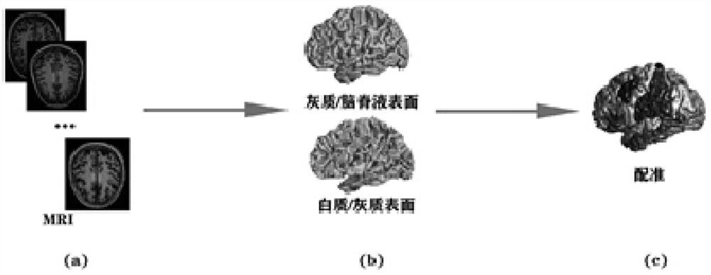 Univariate neurodegenerative biomarker for AD (Alzheimer's disease) early discovery