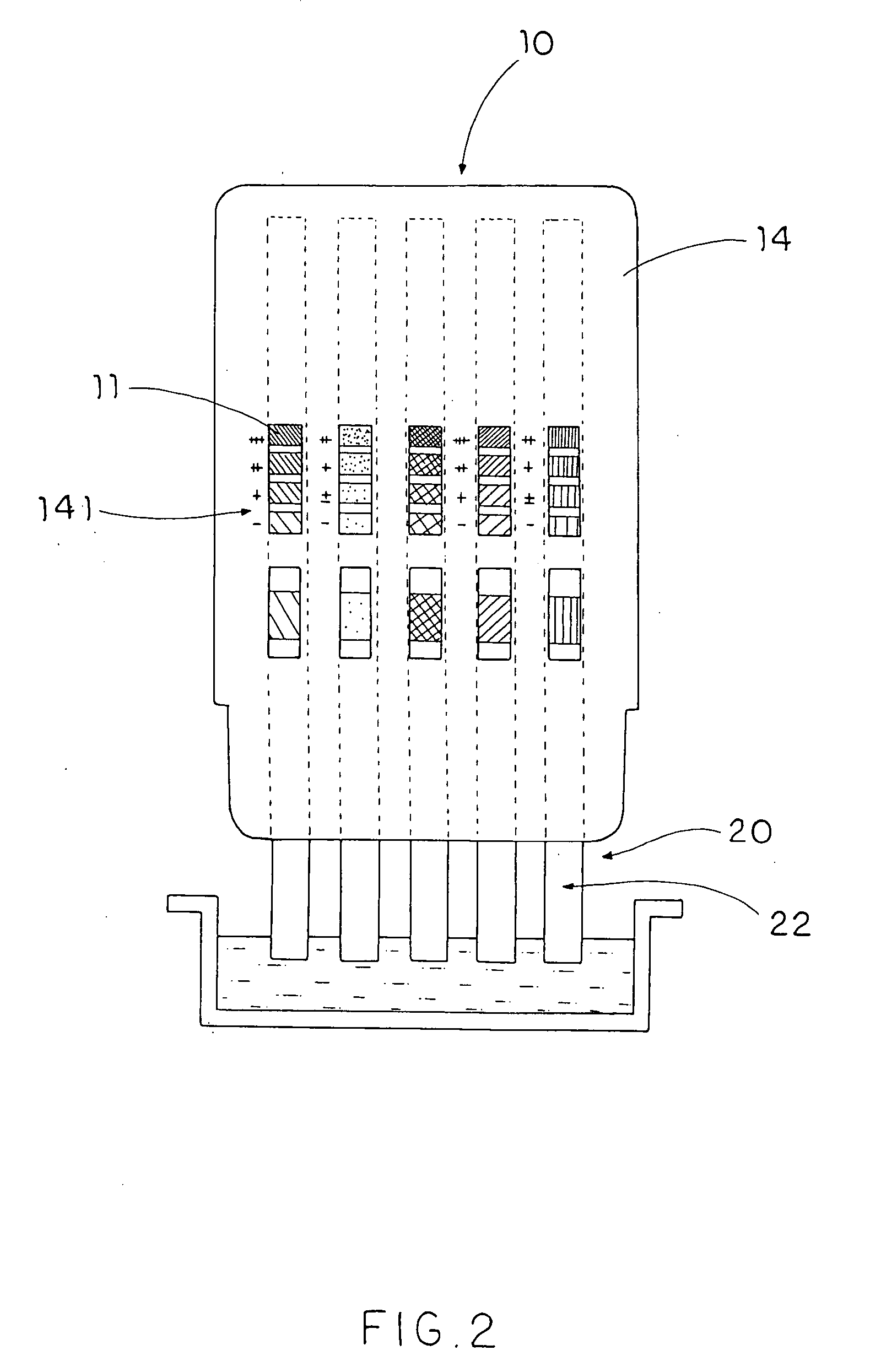 Urinary Diagnosis process