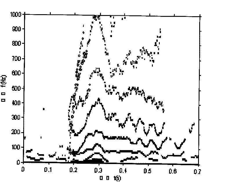 Method for acquiring vocal print picture with refined time-frequency structure