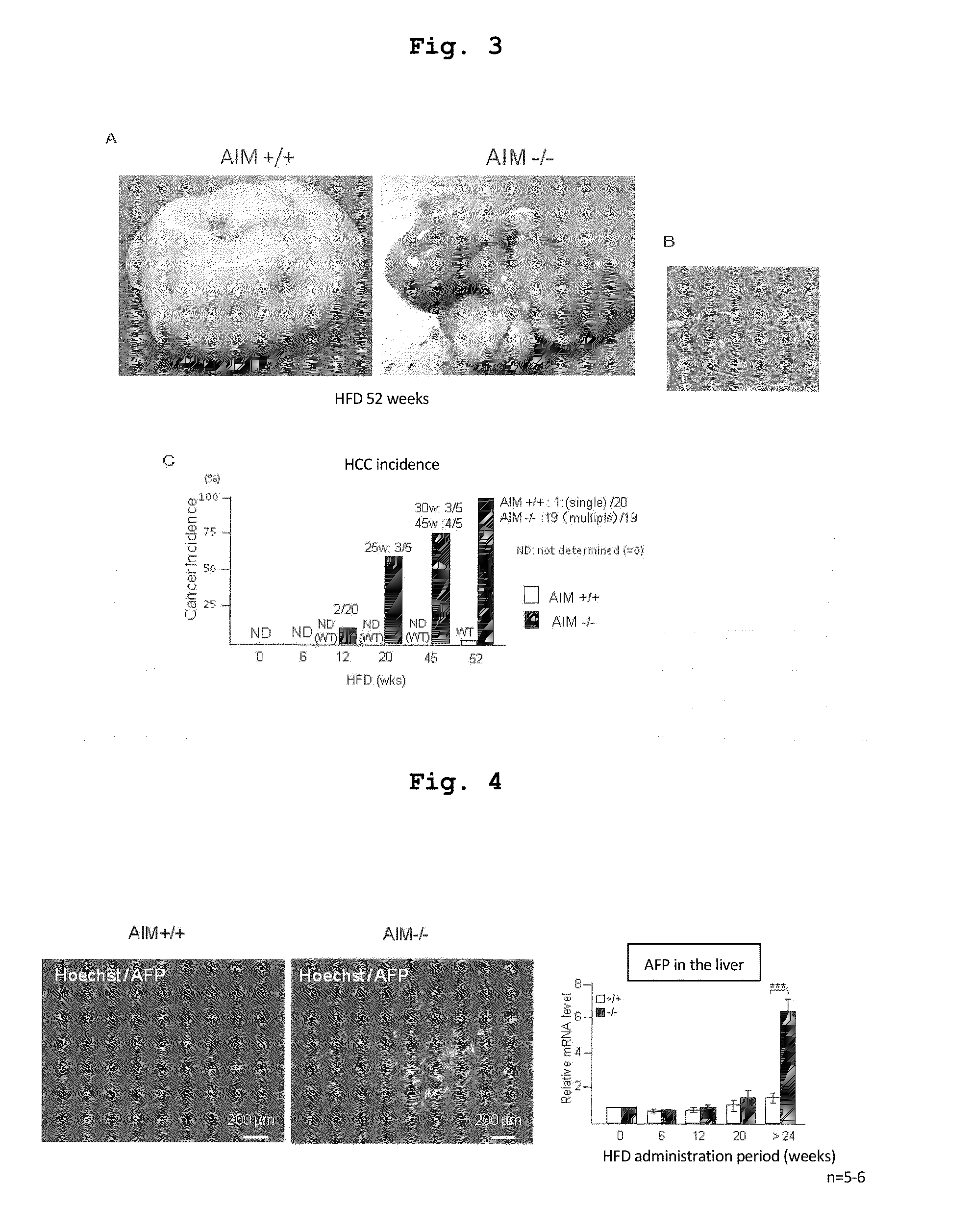 Prophylactic or therapeutic agent for hepatic diseases