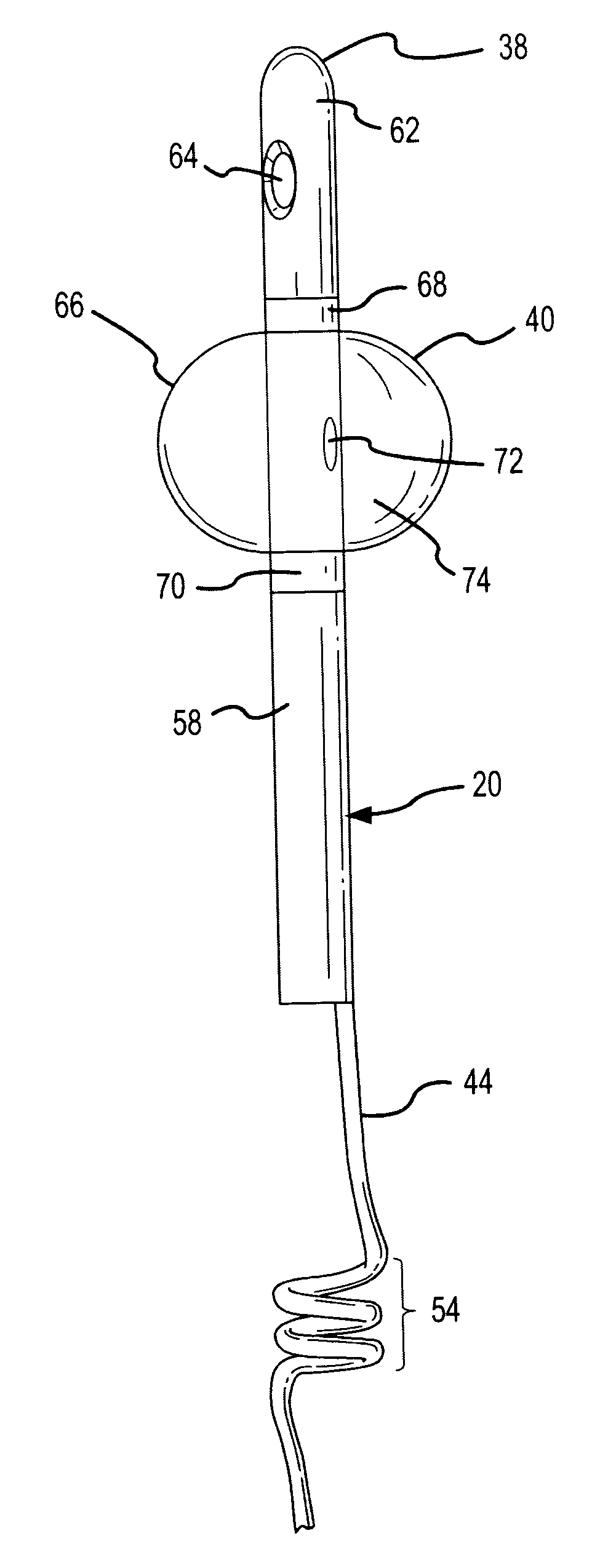 Partial-length, indwelling prostatic catheter using coiled inflation tube as an anchor and methods of draining urine and flushing clots