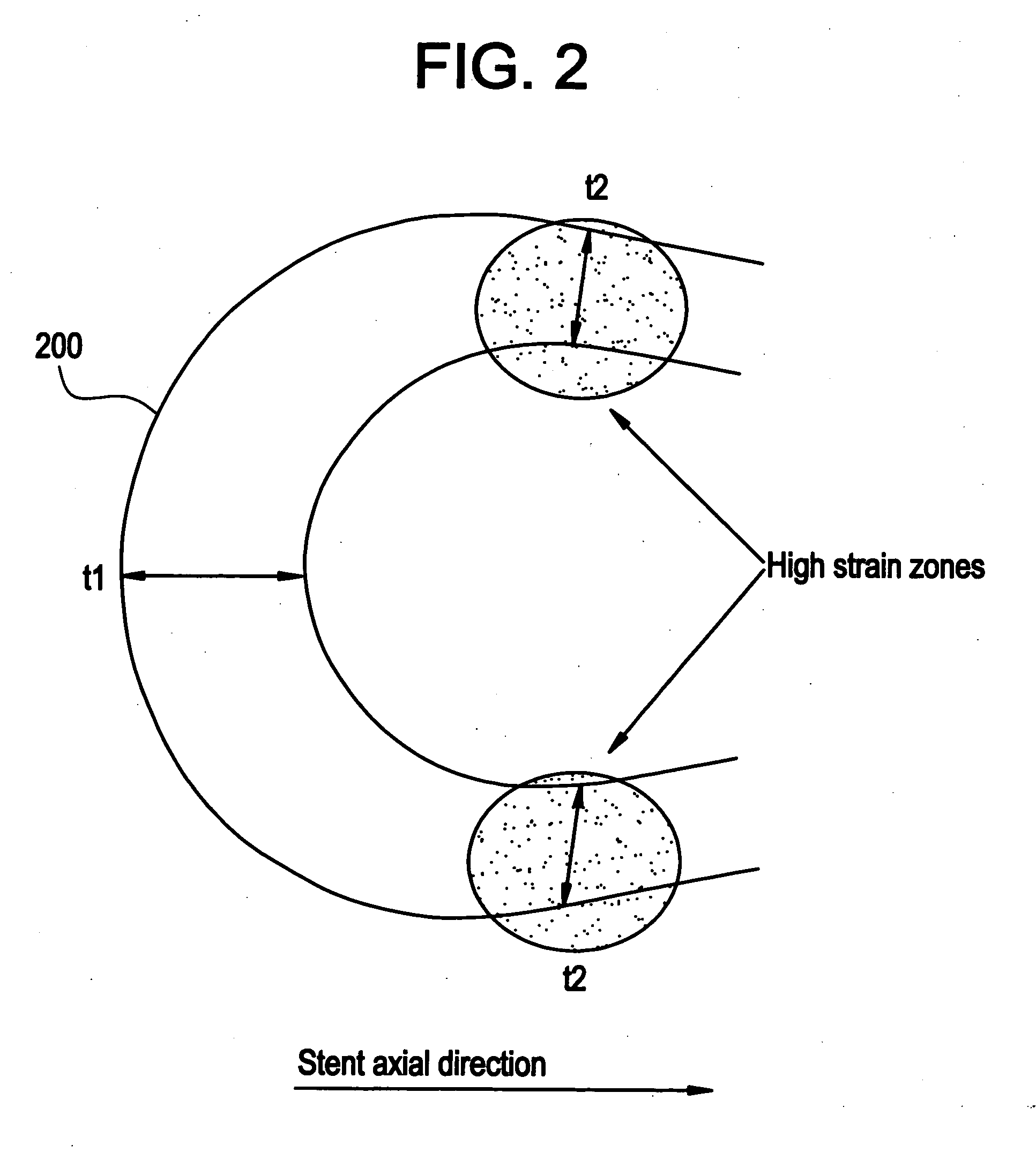 Polymeric stent having modified molecular structures in selected regions of the hoops and method for making the same