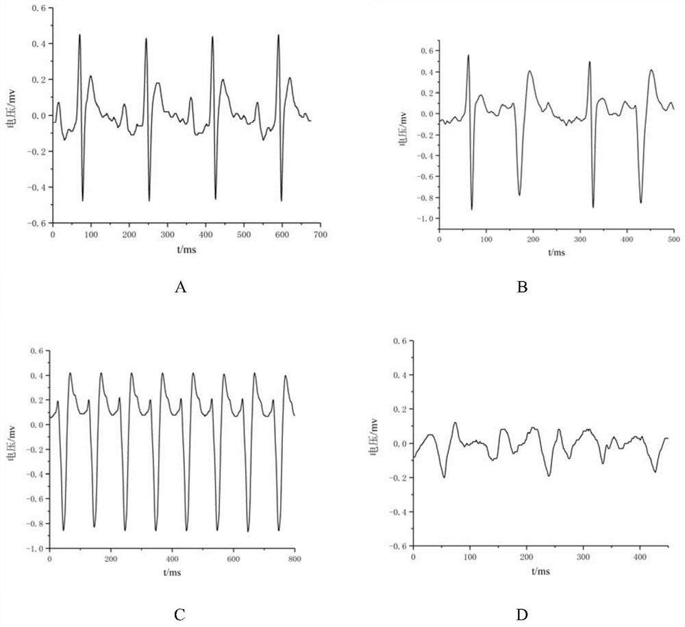 Low-toxicity antiarrhythmic medicine and preparation method thereof