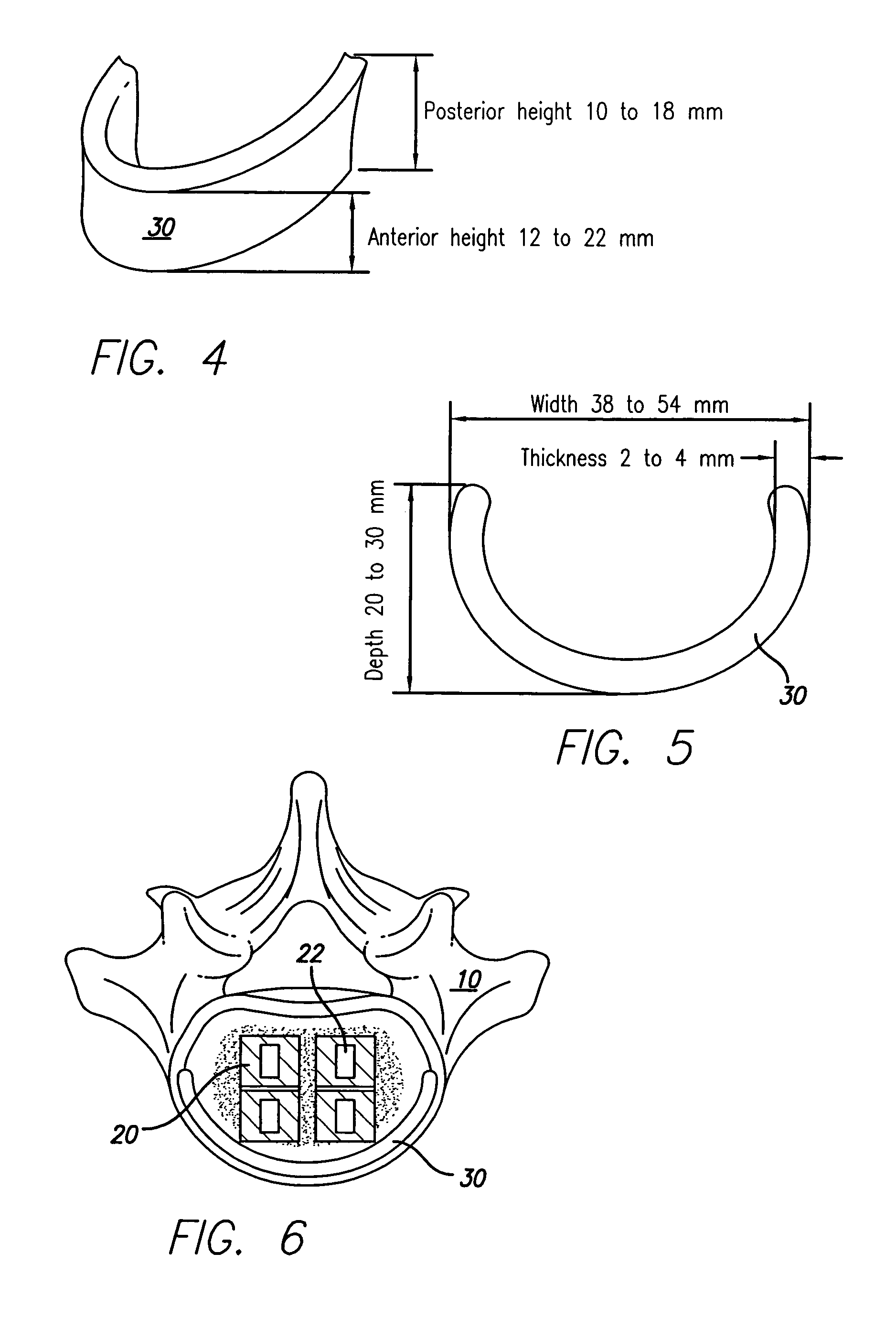 Support device for vertebral fusion