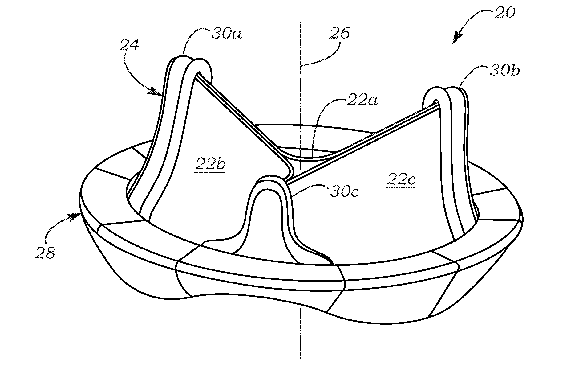 Anatomically Approximate Prosthetic Mitral Valve