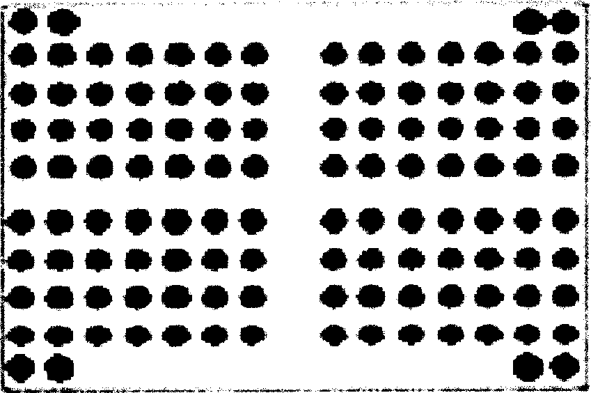 Preparation and method of lamifuding drug resistant gene chip for hepatitis virus B type