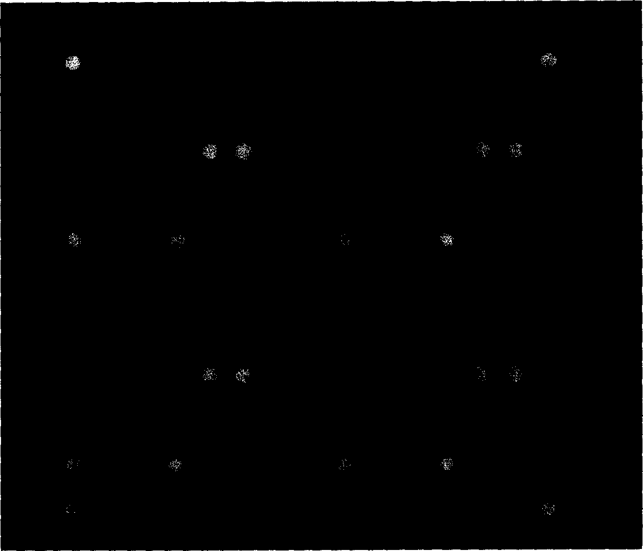 Preparation and method of lamifuding drug resistant gene chip for hepatitis virus B type