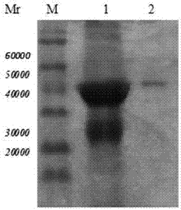 Trichina 7TR protein human single-chain antibody and preparation method and medical application