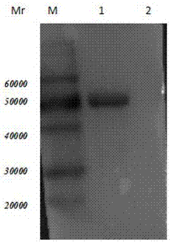 Trichina 7TR protein human single-chain antibody and preparation method and medical application