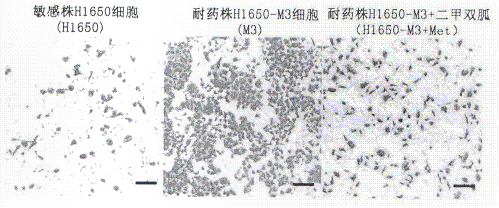 EGFR-TKI compound for delaying or reversing drug-resistance in lung cancer treatment, and preparation thereof