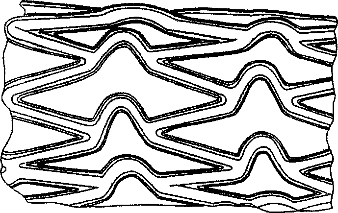 Preparation of polymer drug-laden coating on cardiovascular stent