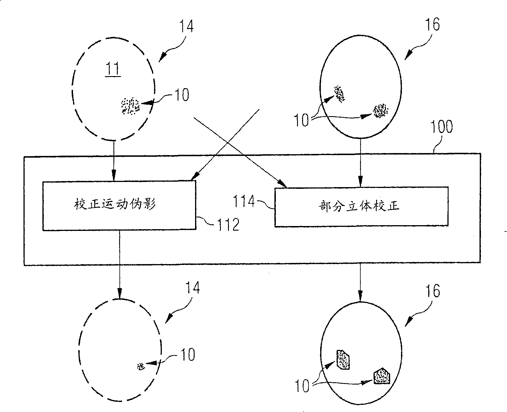 Method for detecting a brain region with neurodegenerative change