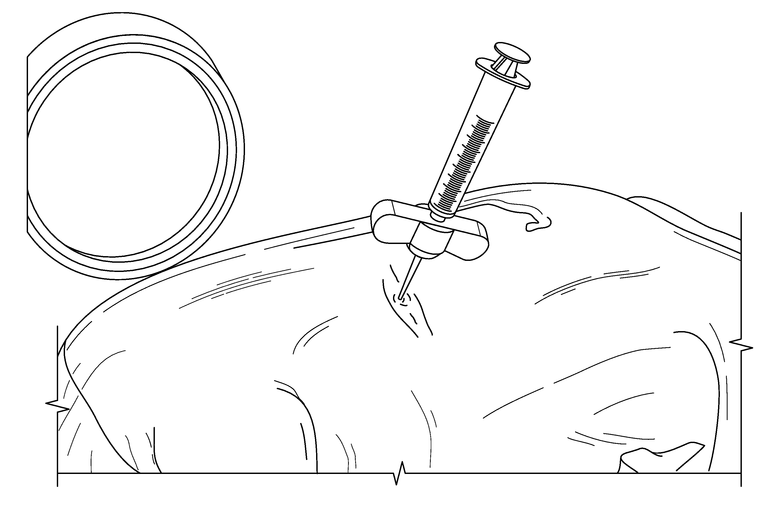 Compositions and methods for treating the vertebral column