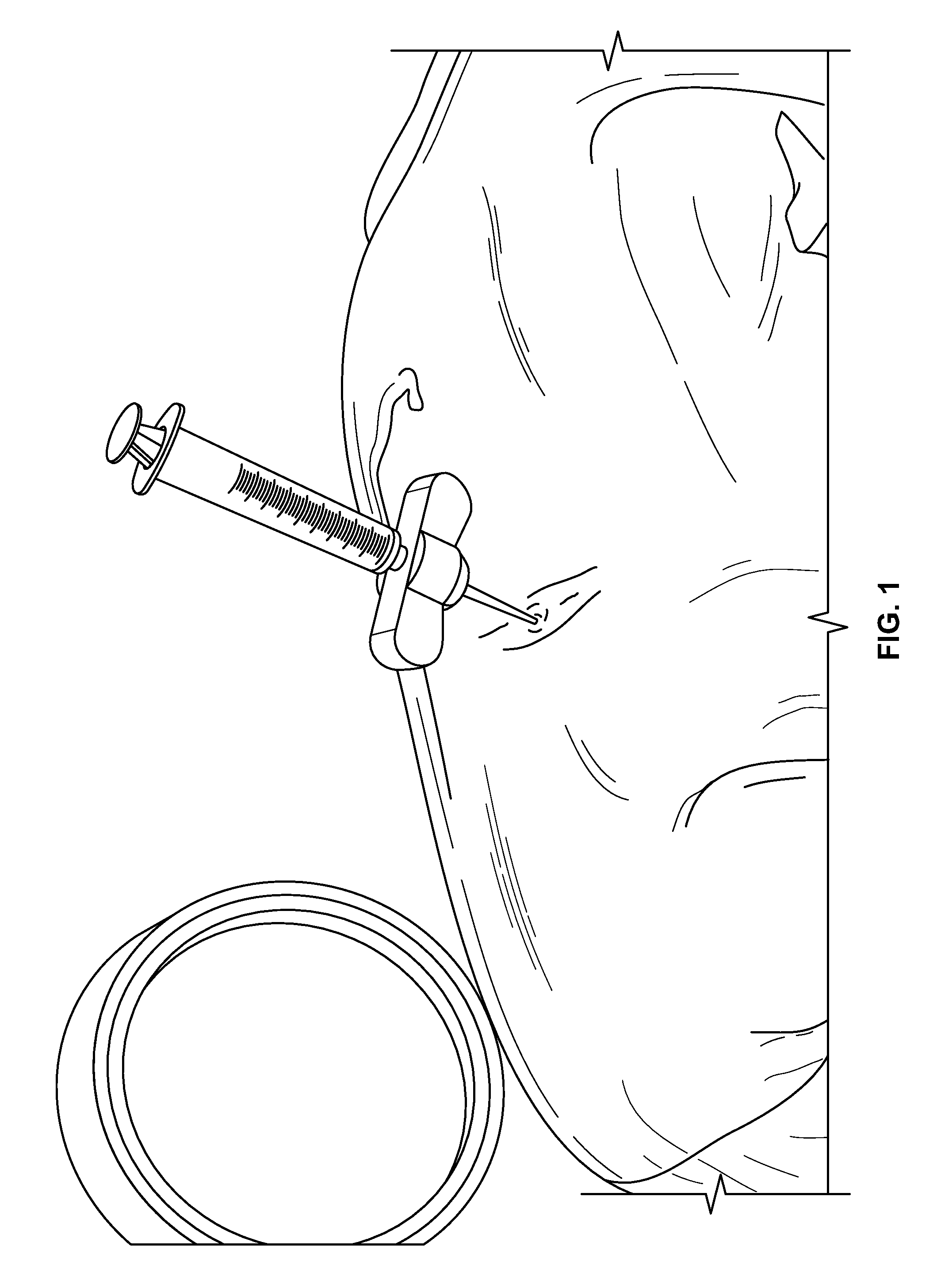 Compositions and methods for treating the vertebral column