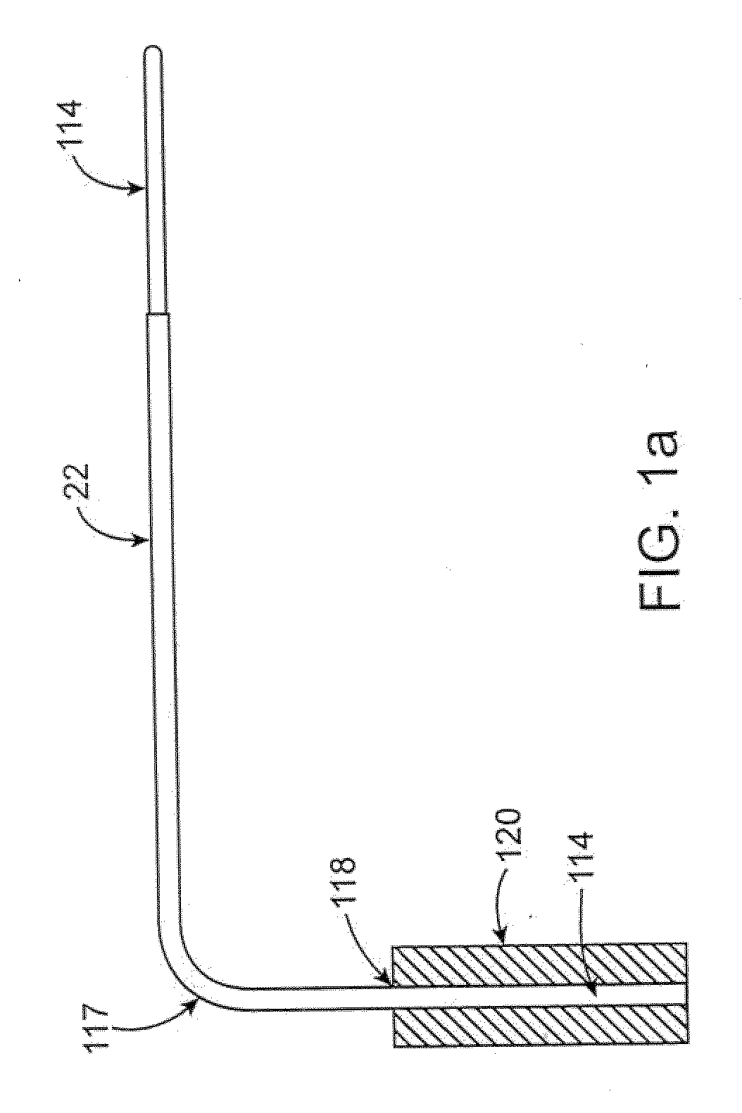 Ultrasound catheter and methods for making and using same