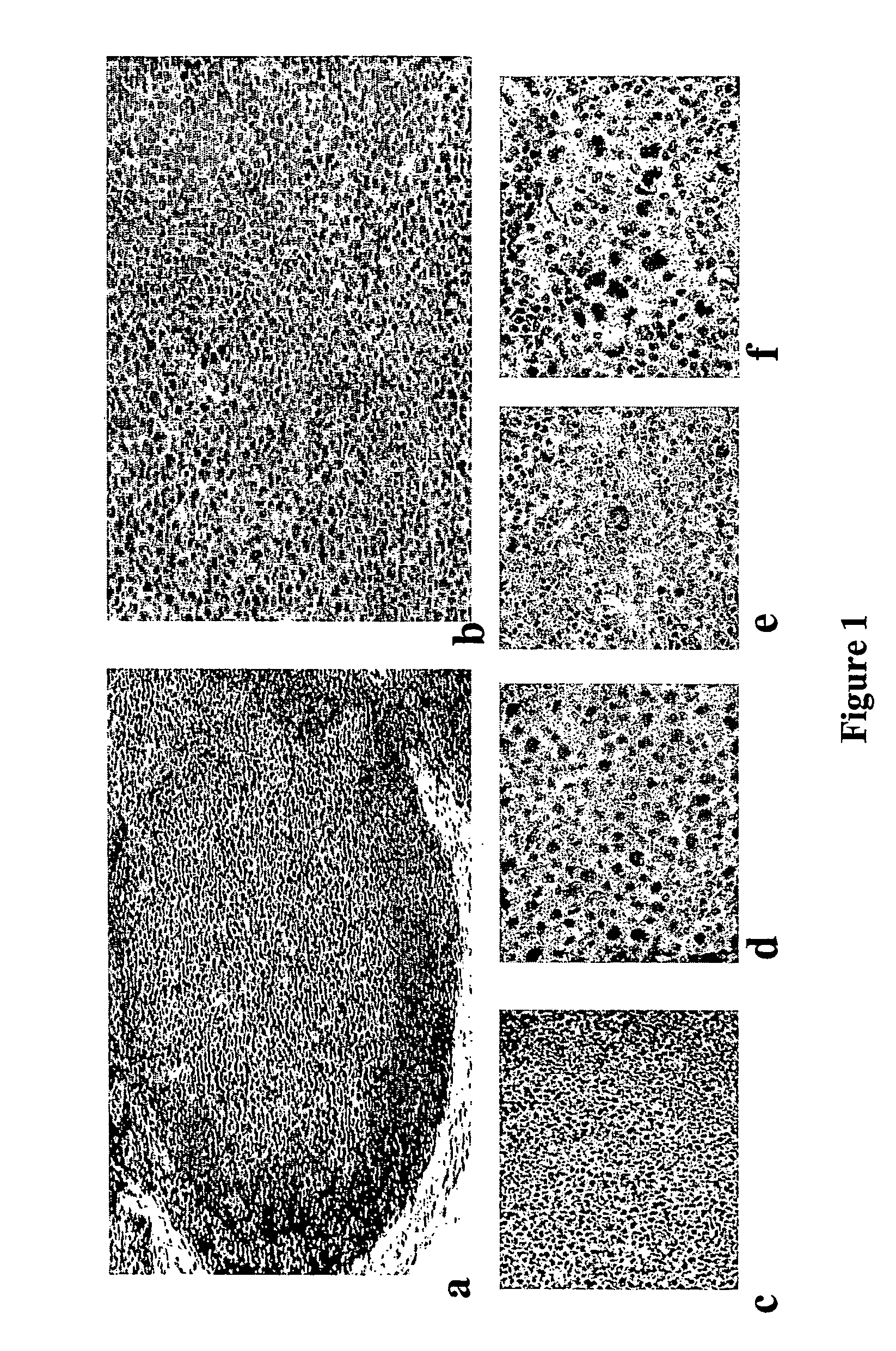 Methods For Determining Presence of Cancer by Analyzing the Expression of Cdk9 and/or Cyclin T1 in Lymphoid Tissue