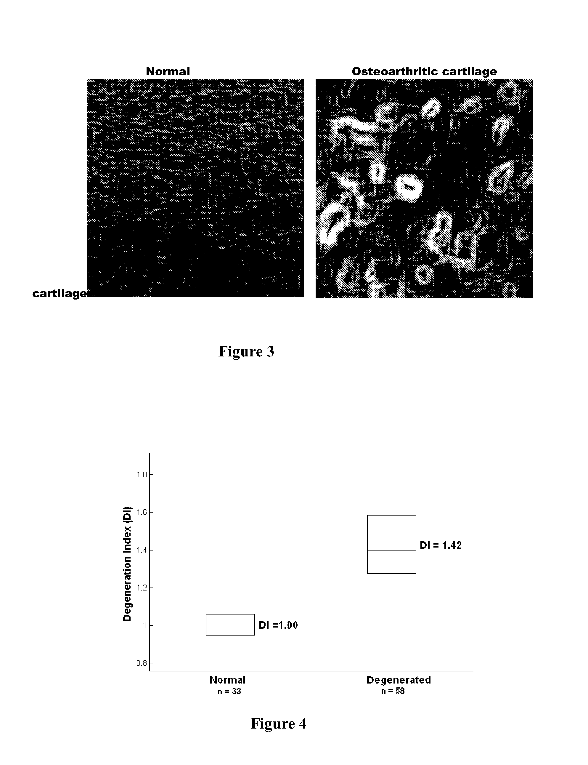 Camera Arrangement and Image Processing Method for Quantifying Tissue Structure and Degeneration