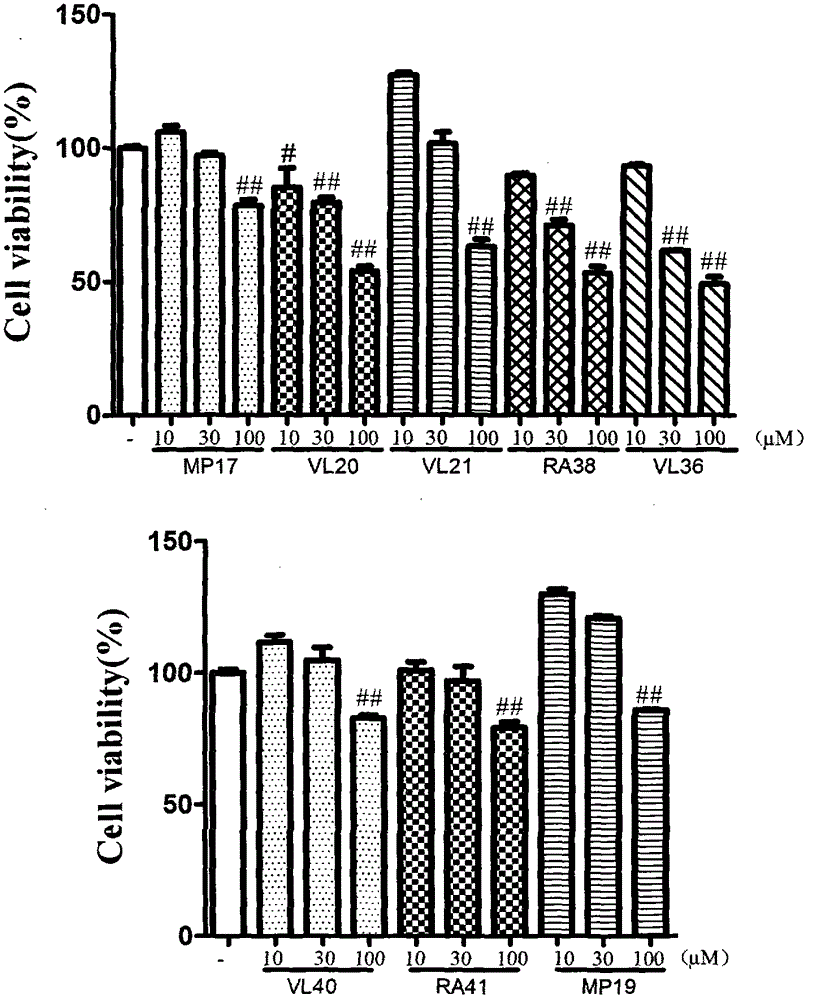 Dimer of rivastigmine and caffeic acid or ferulic acid, preparation method and drug composition thereof