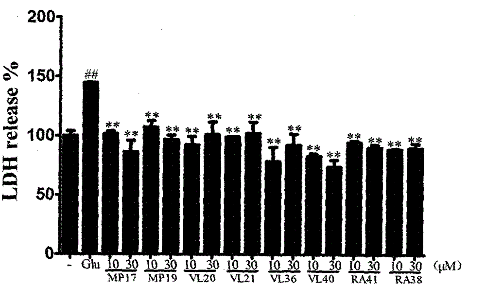 Dimer of rivastigmine and caffeic acid or ferulic acid, preparation method and drug composition thereof