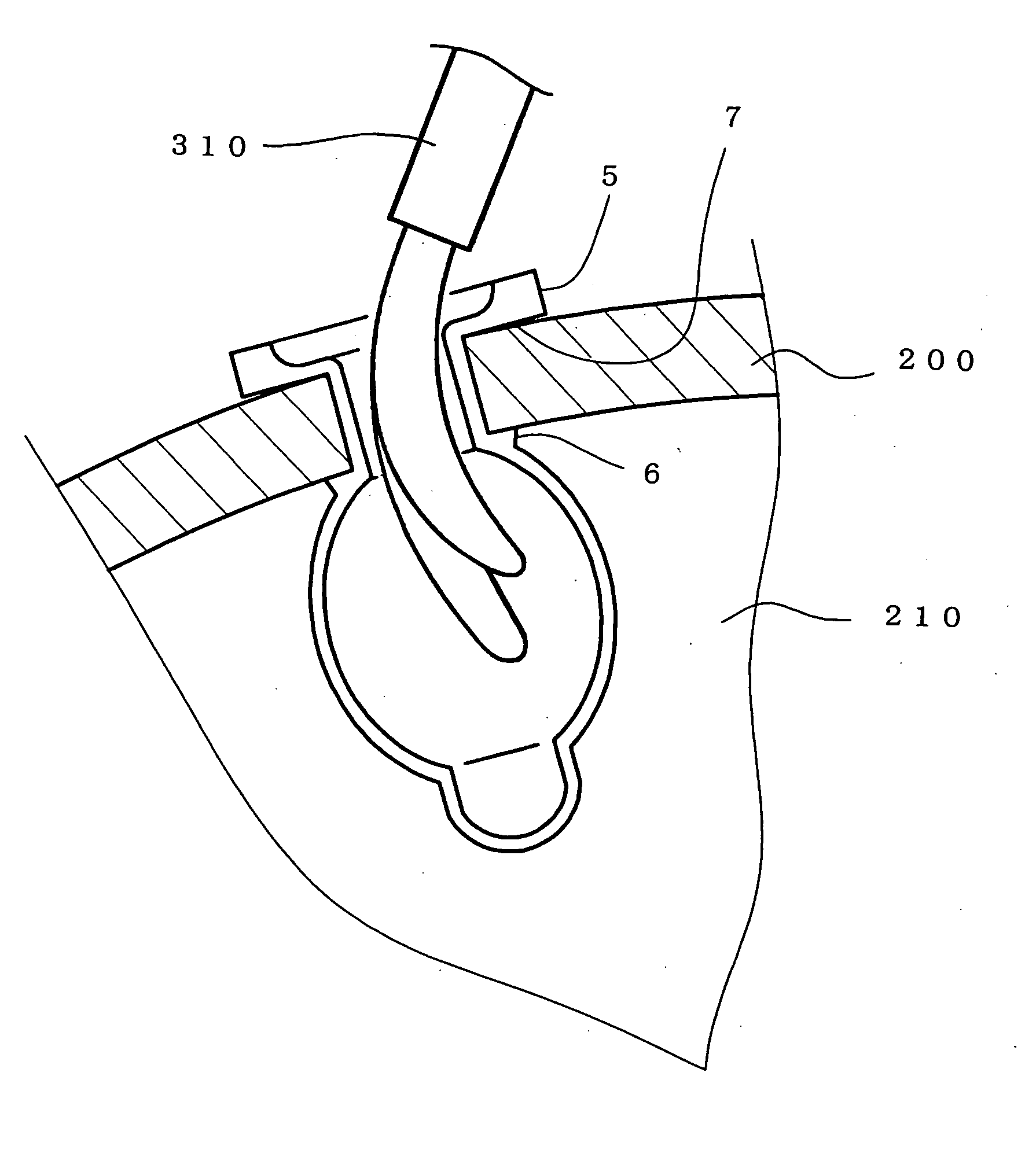 Ophthalmic Cannula