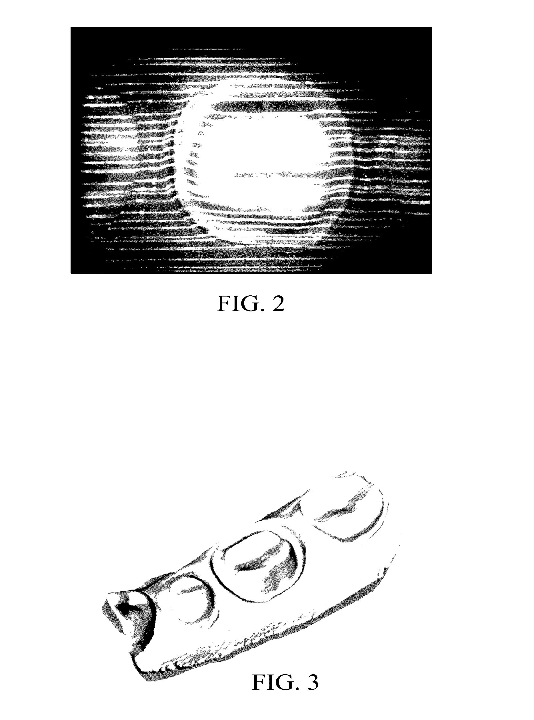 Intra-oral scanner with color tip assembly