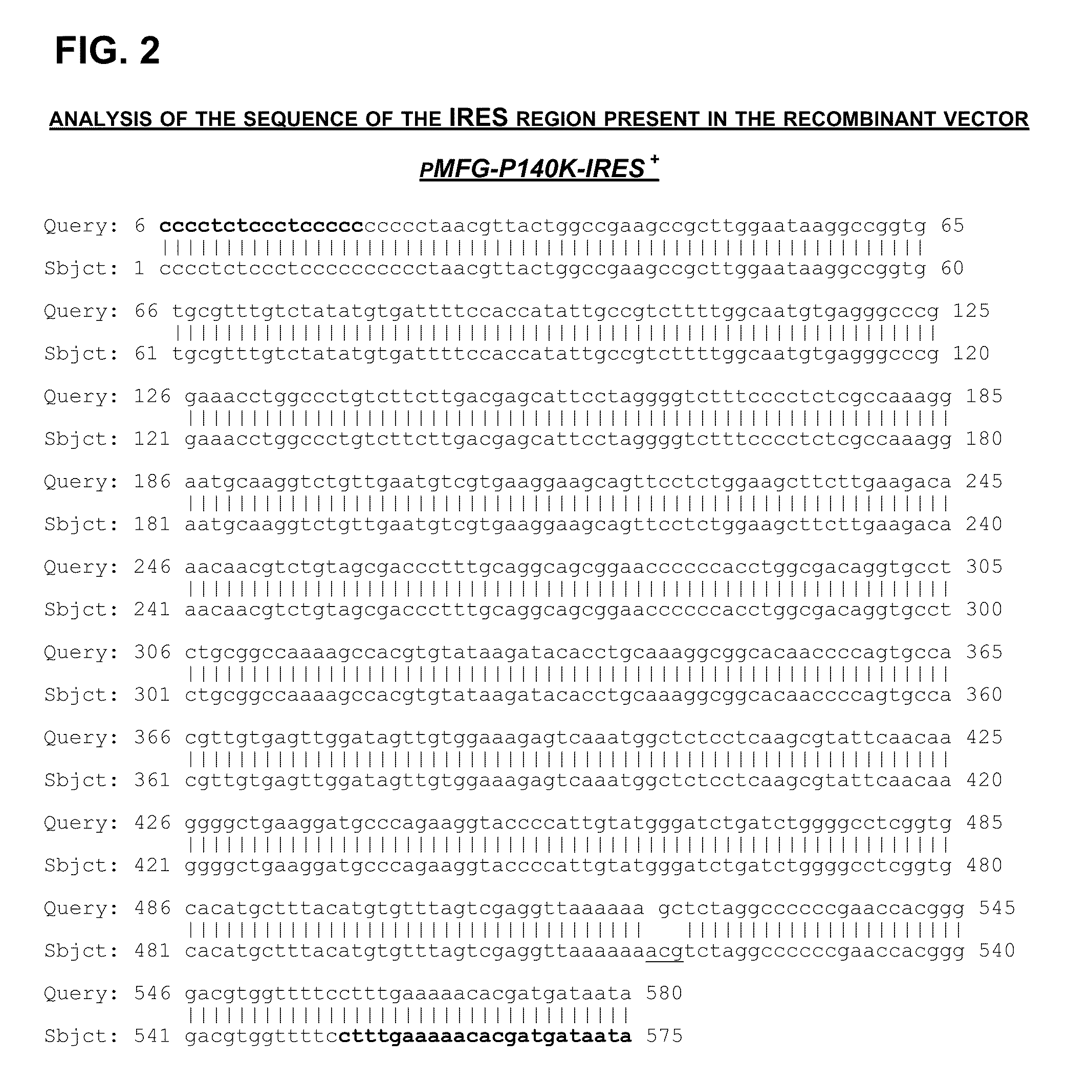 Recombinant human blood coagulation factor VIII protein, composition, use of a recombinant factor VIII protein, use of a composition, method of obtaining a recombinant human blood coagulation factor VIII protein and use thereof