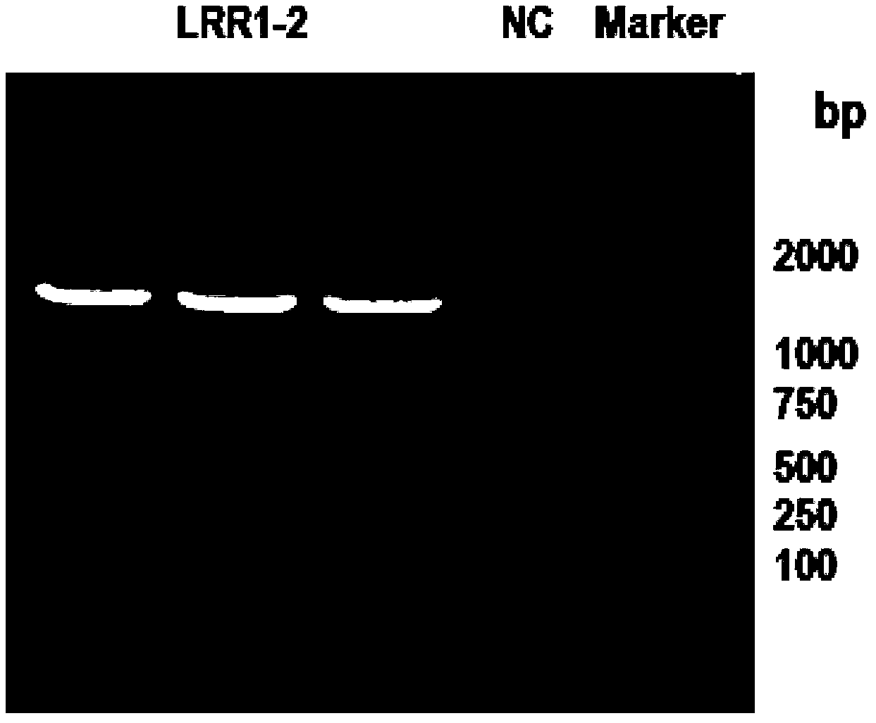 Fusion protein containing leucine-rich repetitive sequence, and preparation method and application thereof