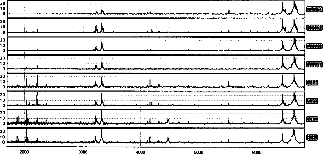 Testing mass spectrum model of blood serum protein in carcinoma of large intestine and its creating method