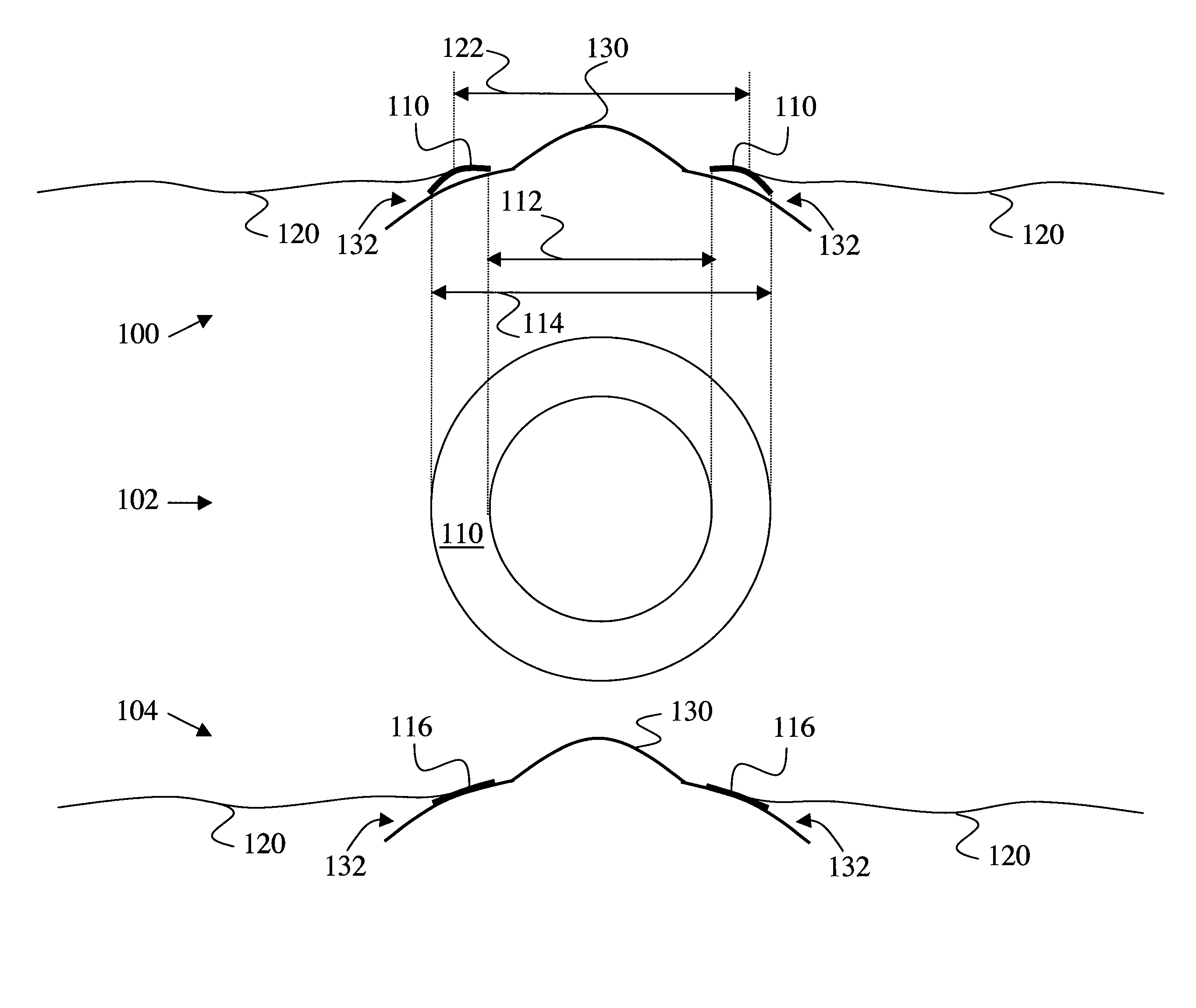 Eye drape for surgical procedures