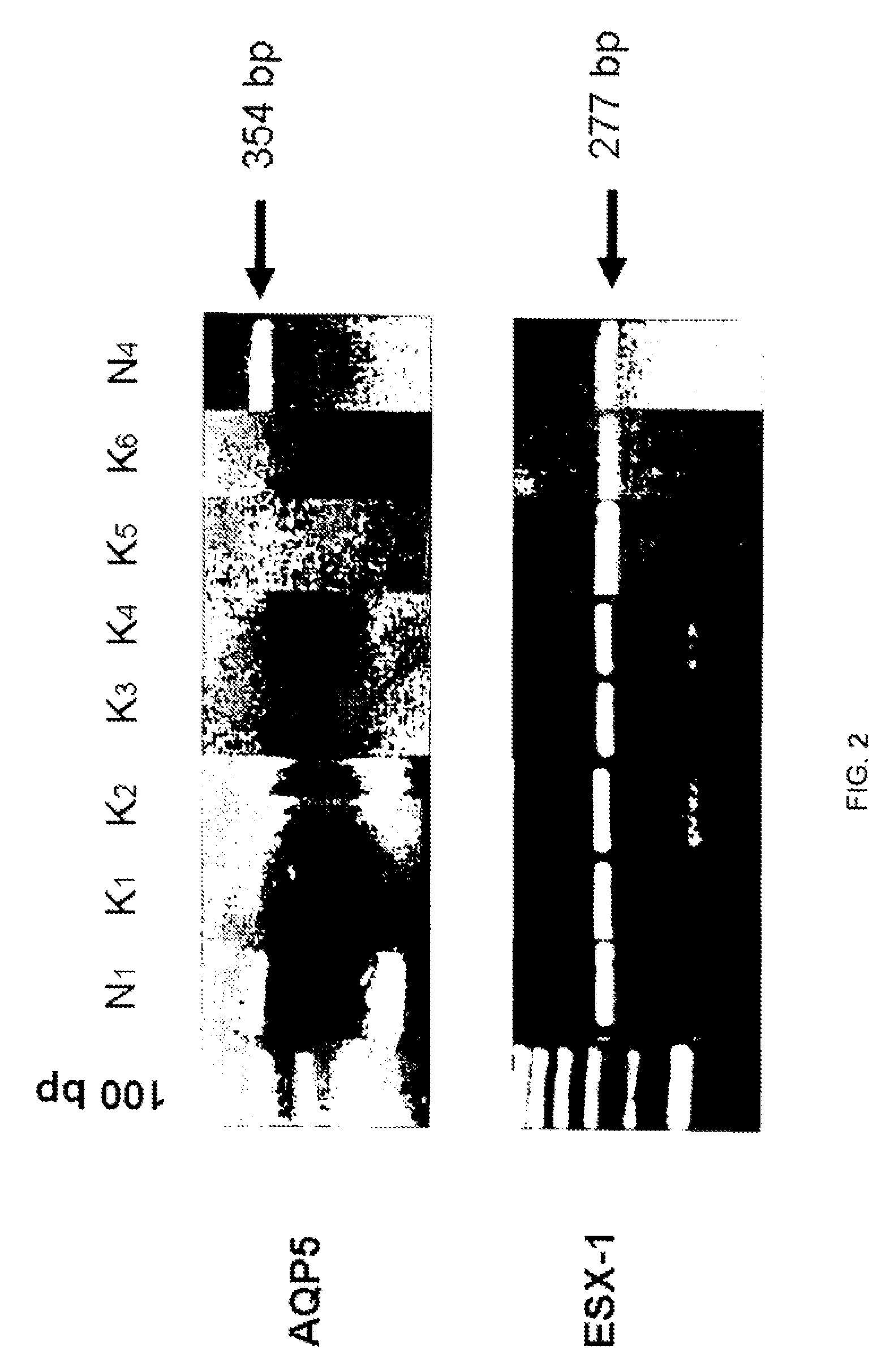 Compositions and methods for detecting keratoconus