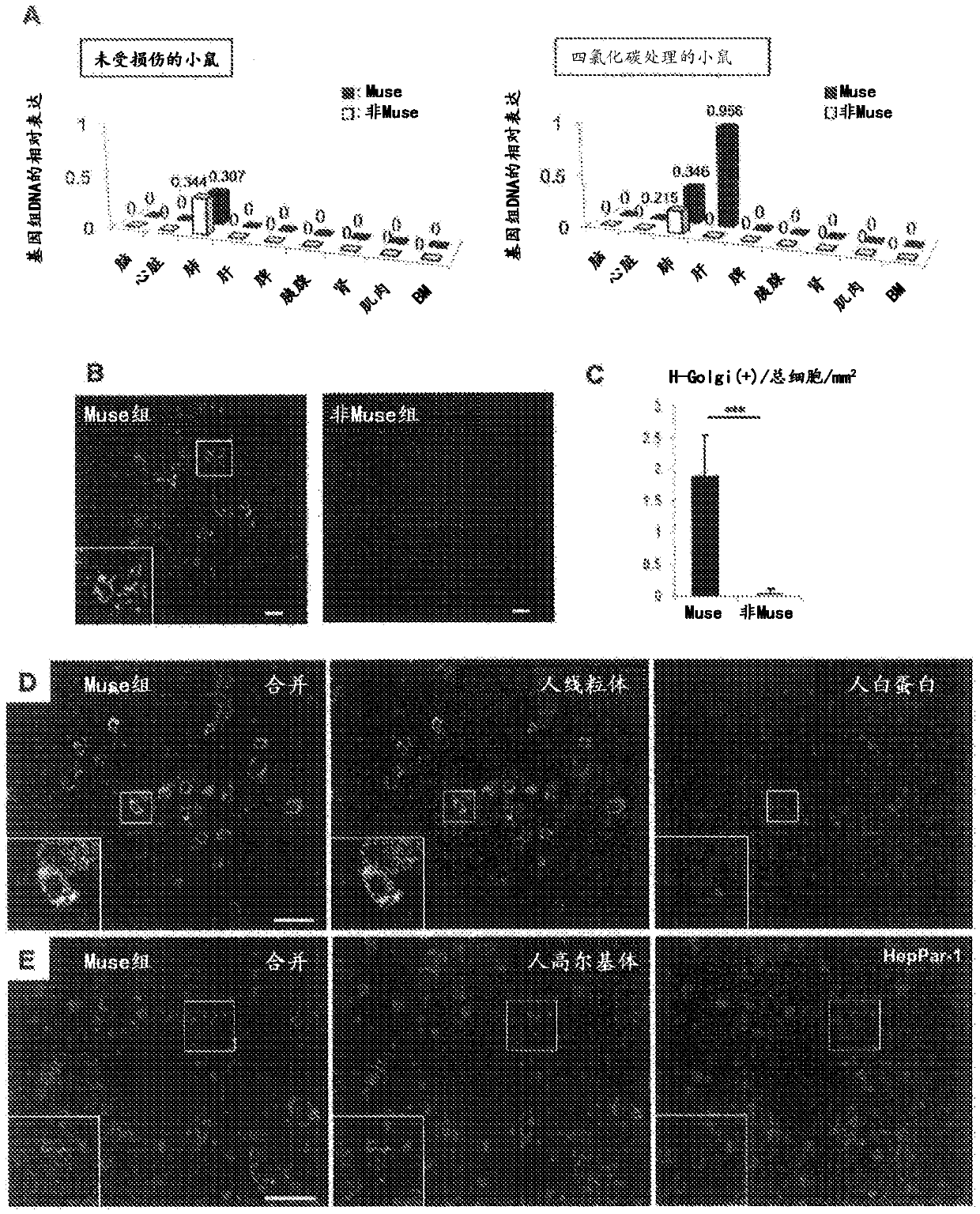 Prophylactic or therapeutic agent for organ fibrosis