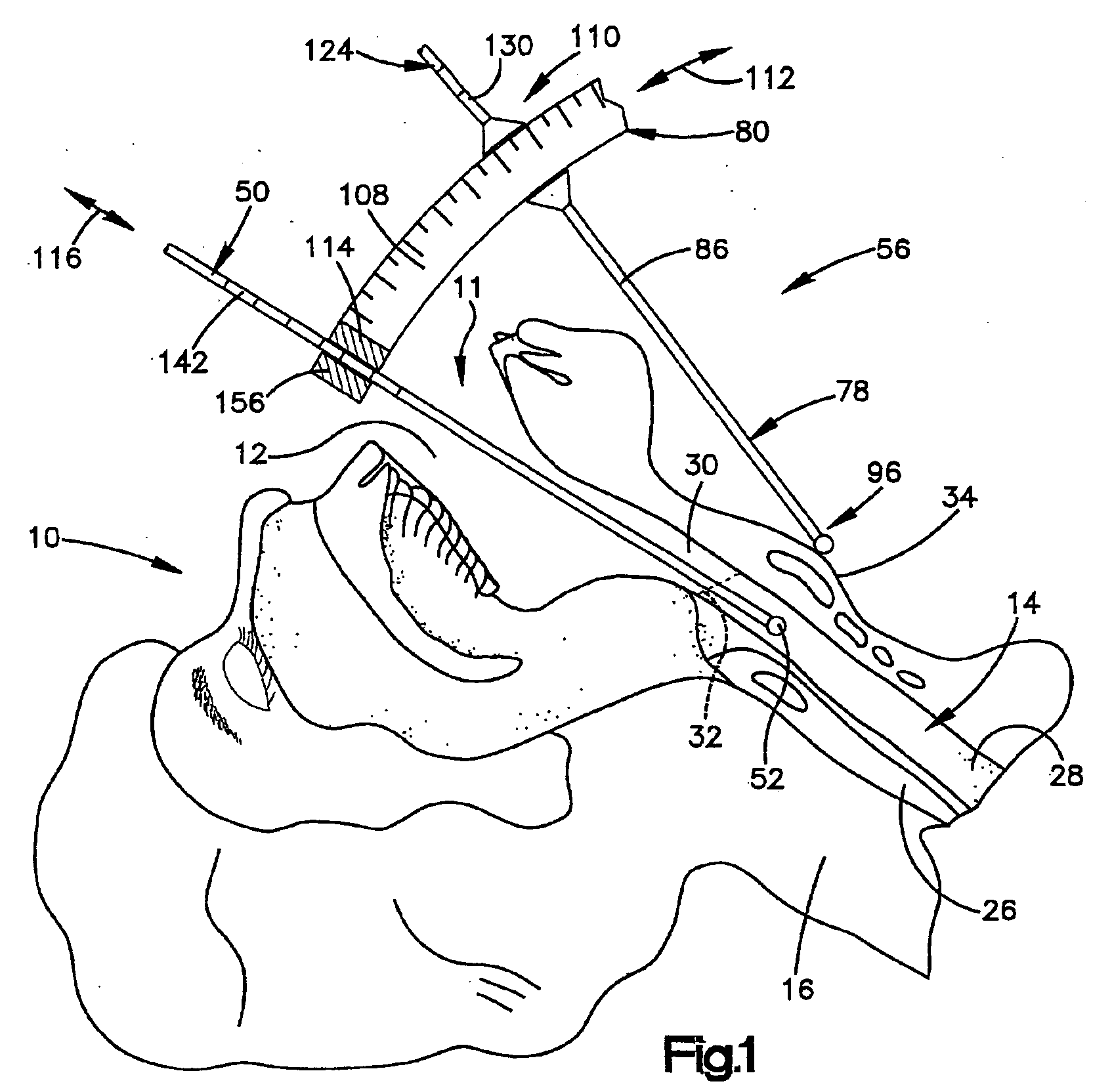 Medical device positioning system and method