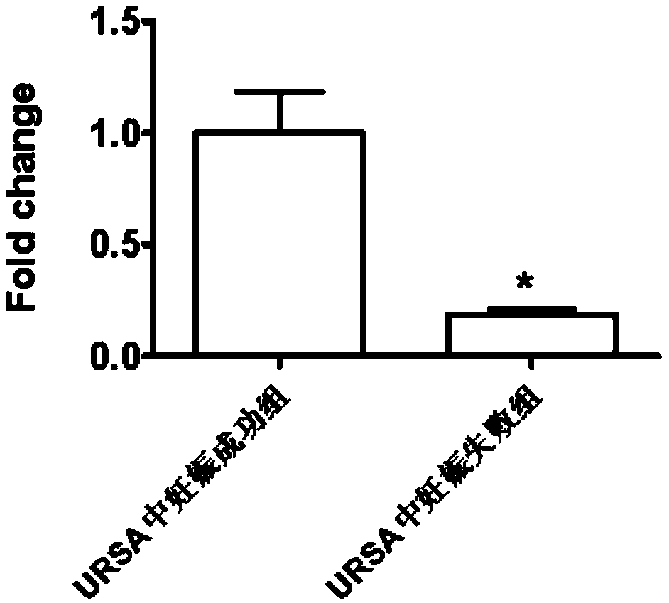 Application of LncRNA in serum as marker to URSA diagnosis and pregnancy outcome evaluation