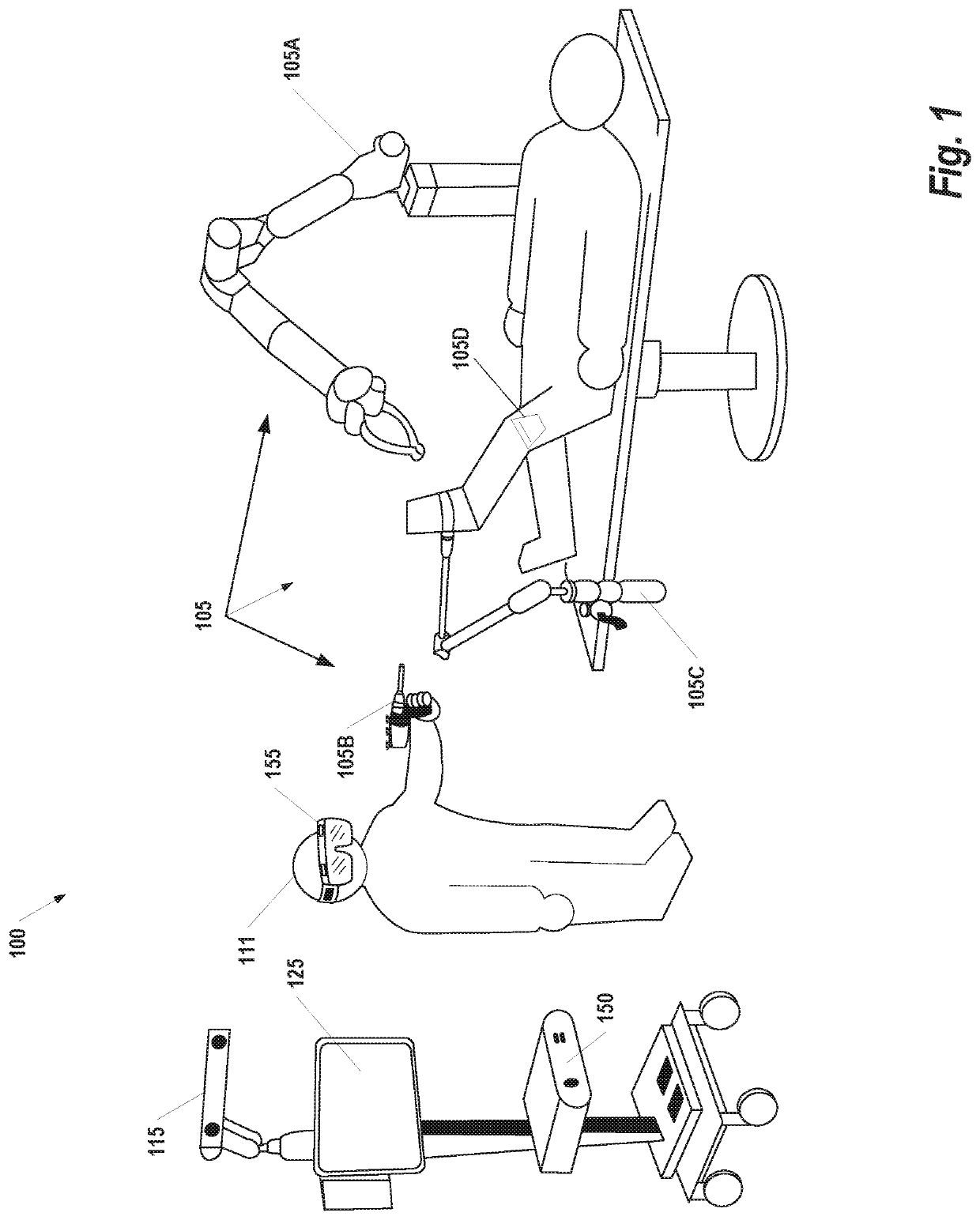 Osteochondral defect treatment method and system