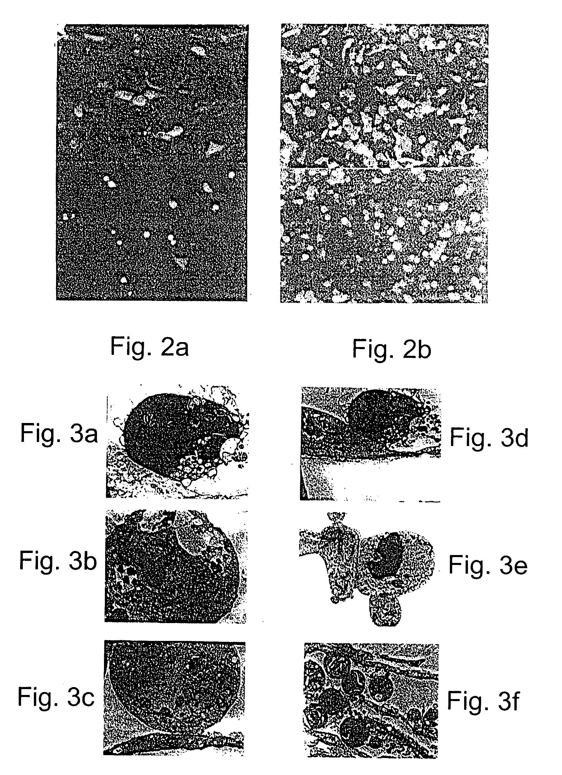 Promoters exhibiting endothelial cell specificity and methods of using same for regulation of angiogenesis