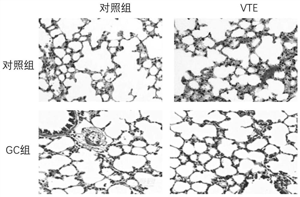 Application of glucocorticoid in preparation of medicine for preventing and treating venous embolism