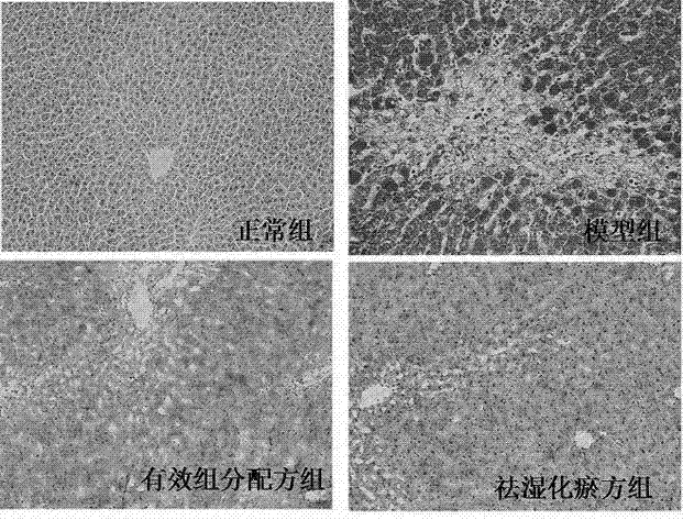 Traditional Chinese compound medicament for treating fatty liver disease