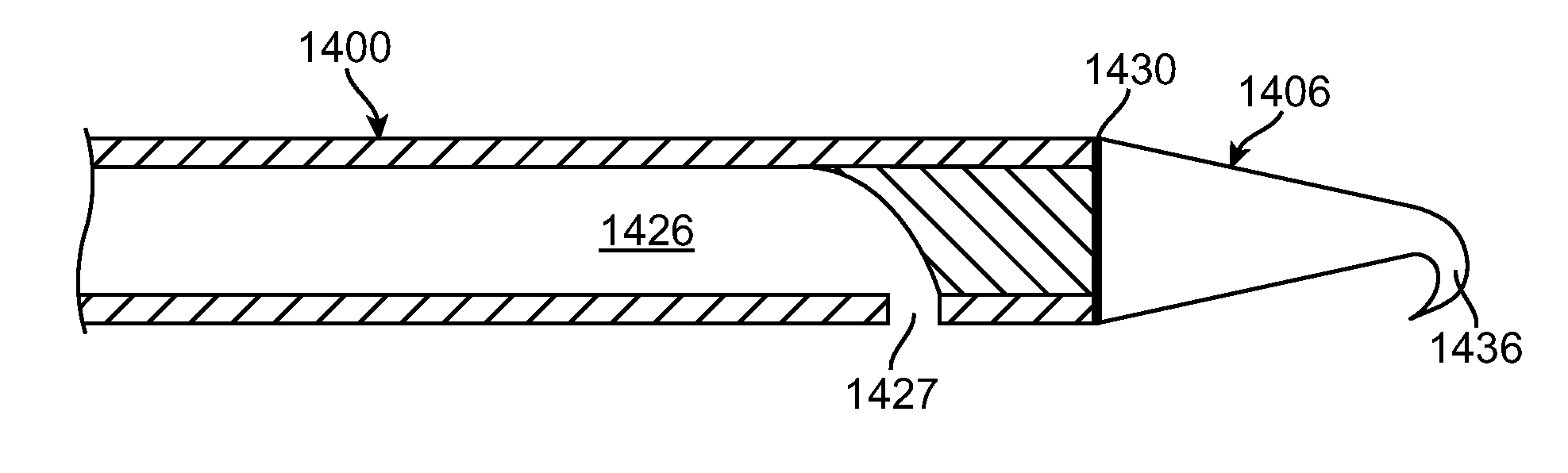 Catheter having a detachable tip